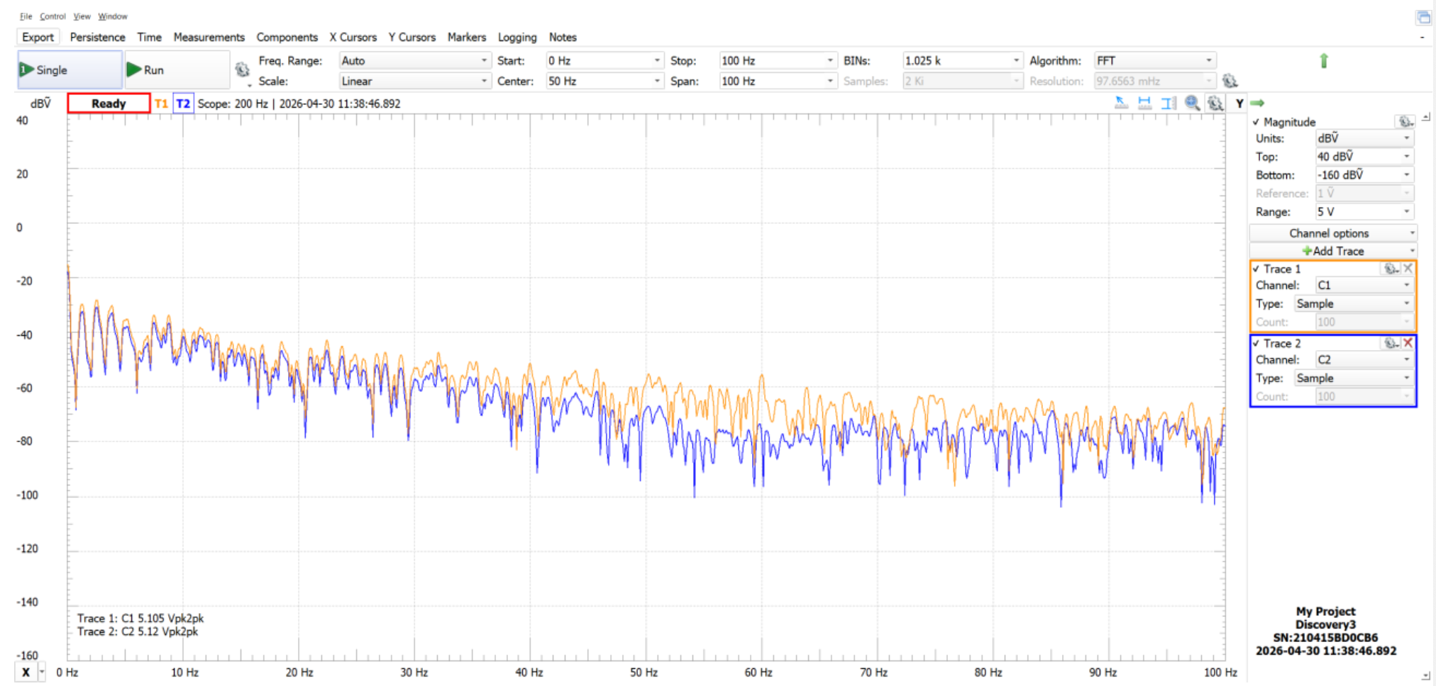 ECG frequency spectrum before and after 60 Hz notch filtering
