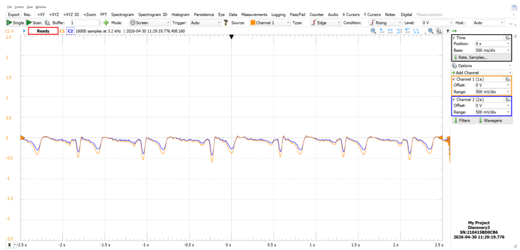 ECG signal before and after 60 Hz notch filtering